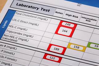 LDL-C may predict the presence and extent of atherosclerosis in patients without significant CV risk factors. LDL-C may predict the presence and extent of atherosclerosis in patients without significant CV risk factors.