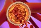 Diabetes Independently Associated With Coronary Artery Calcification Diabetes Independently Associated With Coronary Artery Calcification