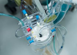 Recommendations focused on heparin dosing, contraindications and alternatives to heparin, and anticoagulation reversal. Recommendations focused on heparin dosing, contraindications and alternatives to heparin, and anticoagulation reversal.