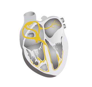 Patients with left bundle branch block had the highest combined end point of heart failure hospitalization or mortality. Patients with left bundle branch block had the highest combined end point of heart failure hospitalization or mortality.