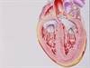 Androgen Deprivation Linked With Heart Failure Androgen Deprivation Linked With Heart Failure