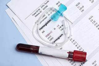 The A/C glycemic ratio was a major independent predictor of troponin I peak values in patients with diabetes who had an AMI, after adjustment for confounders. The A/C glycemic ratio was a major independent predictor of troponin I peak values in patients with diabetes who had an AMI, after adjustment for confounders.