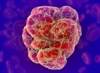 ASH: New Venous Thromboembolism Clinical Practice Guideline ASH: New Venous Thromboembolism Clinical Practice Guideline