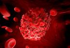 Pulmonary Embolism Rule-Out Criteria Can Identify Thromboembolic Events Pulmonary Embolism Rule-Out Criteria Can Identify Thromboembolic Events
