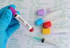 Guidelines Released With New HbA1c Targets for Adults With Type 2 Diabetes Guidelines Released With New HbA1c Targets for Adults With Type 2 Diabetes