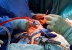 CABG May Have Better Outcomes Than PCI in Diabetes With LV Dysfunction CABG May Have Better Outcomes Than PCI in Diabetes With LV Dysfunction