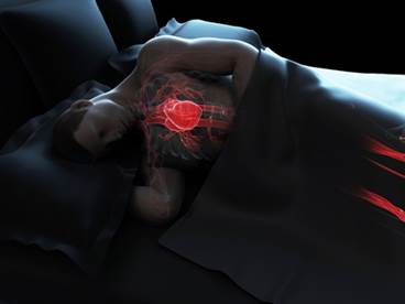 The Connection Between Cardiovascular Disease and Sleep Apnea: An Expert Interview The Connection Between Cardiovascular Disease and Sleep Apnea: An Expert Interview