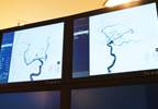 FDA: Increased Image Artifact in MRA With Neurovascular Embolization Coils FDA: Increased Image Artifact in MRA With Neurovascular Embolization Coils