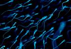 Low Sperm Count Associated With Worse Metabolic, Cardiovascular, and Bone Health Low Sperm Count Associated With Worse Metabolic, Cardiovascular, and Bone Health