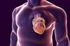 ADA Updates Guidelines for Cardiovascular Risk Management in Diabetes ADA Updates Guidelines for Cardiovascular Risk Management in Diabetes