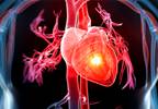 High Financial Burden for Families of Patients With ASCVD High Financial Burden for Families of Patients With ASCVD