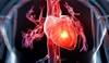Cardioprotective Treatment May Reduce Adverse Effects in Schizophrenia Cardioprotective Treatment May Reduce Adverse Effects in Schizophrenia