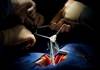 Increased Stroke Risk Following Surgical vs Transfemoral Aortic Valve Replacement Increased Stroke Risk Following Surgical vs Transfemoral Aortic Valve Replacement