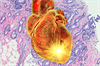 AHA Examines CVD and Breast Cancer Relationship AHA Examines CVD and Breast Cancer Relationship