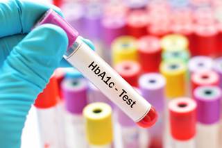 The relationship between diabetes distress and HbA1c was moderated by autonomy support. The relationship between diabetes distress and HbA1c was moderated by autonomy support.