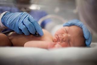 During spring, there were also large increases in specific CHD subtypes. During spring, there were also large increases in specific CHD subtypes.