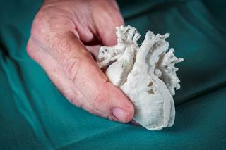 Simulated surgery can be performed with 3D-printed models. <i>Photo Credit: Arno Massee/Science Source</i> Simulated surgery can be performed with 3D-printed models. <i>Photo Credit: Arno Massee/Science Source</i>