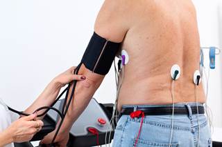 Cardiac stress testing rates were compared for patients with CKD and those without CKD. Cardiac stress testing rates were compared for patients with CKD and those without CKD.