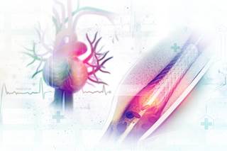 Ischemic stroke risk in patients who receive drug-eluting stents may be mitigated by achieving optimal platelet inhibition. Ischemic stroke risk in patients who receive drug-eluting stents may be mitigated by achieving optimal platelet inhibition.