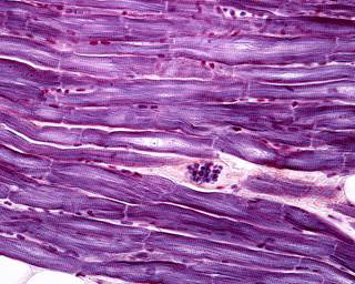 Dabigatran had a low risk for major bleeding events in patients who developed a myocardial injury after noncardiac surgery. Dabigatran had a low risk for major bleeding events in patients who developed a myocardial injury after noncardiac surgery.