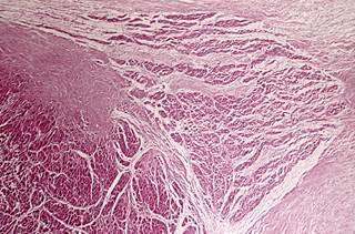 The researchers found that CHD4 protein normally binds directly to DNA in a way that represses the activity of genes that encode non-heart muscle proteins. The researchers found that CHD4 protein normally binds directly to DNA in a way that represses the activity of genes that encode non-heart muscle proteins.
