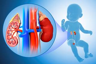 Neonates with left heart obstruction consistently had kidneys that were greater than normal. Neonates with left heart obstruction consistently had kidneys that were greater than normal.