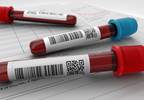 Plasma Acylcarnitines May Indicate Diabetes Risk Among Those at High Risk for CVD Plasma Acylcarnitines May Indicate Diabetes Risk Among Those at High Risk for CVD