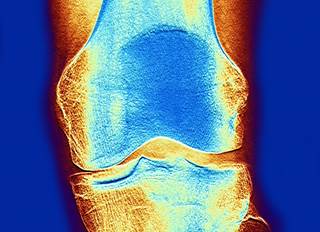 Tibia lead levels are associated with resistant-hypertension. Tibia lead levels are associated with resistant-hypertension.