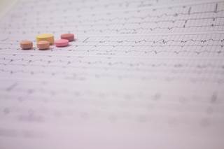 Opioid use is associated with the risk for developing atrial fibrillation. Opioid use is associated with the risk for developing atrial fibrillation.