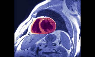 Compared with men, women had higher hazard ratios for MI in association with systolic blood pressure, current smoking, and diabetes. Compared with men, women had higher hazard ratios for MI in association with systolic blood pressure, current smoking, and diabetes.