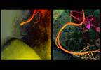 IVUS-Guided DES Implantation Improves Clinical Outcomes in Broad Range of Patients IVUS-Guided DES Implantation Improves Clinical Outcomes in Broad Range of Patients