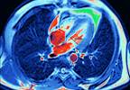 Self-Reported Weight Provides Prognostic Information for Future Heart Failure Risk Self-Reported Weight Provides Prognostic Information for Future Heart Failure Risk