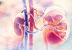 Renal Transplant Improves Survival in ESRD Due to Lupus Renal Transplant Improves Survival in ESRD Due to Lupus