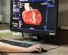 First-in-Human Telerobotic Percutaneous Coronary Intervention Successful First-in-Human Telerobotic Percutaneous Coronary Intervention Successful