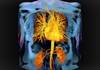 Sustained Improvements in CVD Risk With Intensive T2D Intervention Sustained Improvements in CVD Risk With Intensive T2D Intervention