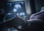 Pregnancy Loss Associated With Increased CHD and Heart Failure Risk Pregnancy Loss Associated With Increased CHD and Heart Failure Risk