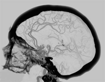 Systemic Vascular Health Associated With Widespread Brain Changes Systemic Vascular Health Associated With Widespread Brain Changes