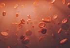 Reversal of Warfarin-Associated Bleeding With 4F-PCC Examined in Obese Patients Reversal of Warfarin-Associated Bleeding With 4F-PCC Examined in Obese Patients