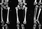 Peripheral Artery Disease: Incidence and Outcomes of Myocardial Infarction Peripheral Artery Disease: Incidence and Outcomes of Myocardial Infarction