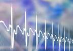 Artificial Intelligence-Enabled ECG May Screen for Asymptomatic LV Dysfunction Artificial Intelligence-Enabled ECG May Screen for Asymptomatic LV Dysfunction