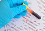 Cardiac Troponin Elevation Predicts Major Adverse Events Even Without Specific Diagnosis Cardiac Troponin Elevation Predicts Major Adverse Events Even Without Specific Diagnosis