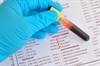 Cardiac Troponin Elevation on Hospital Admission Predicts MAEs Even Without Specific Diagnosis Cardiac Troponin Elevation on Hospital Admission Predicts MAEs Even Without Specific Diagnosis