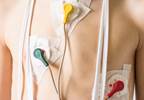Missed Diagnosis of New-Onset Systolic Heart Failure Common in Children Missed Diagnosis of New-Onset Systolic Heart Failure Common in Children