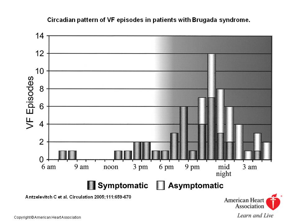 Brugada Syndrome