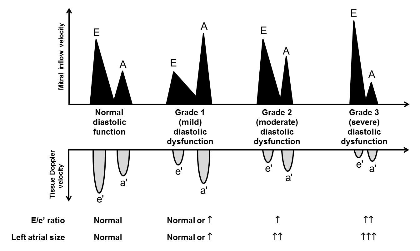 Recognition and Management of the Patient with Stage B Heart Failure