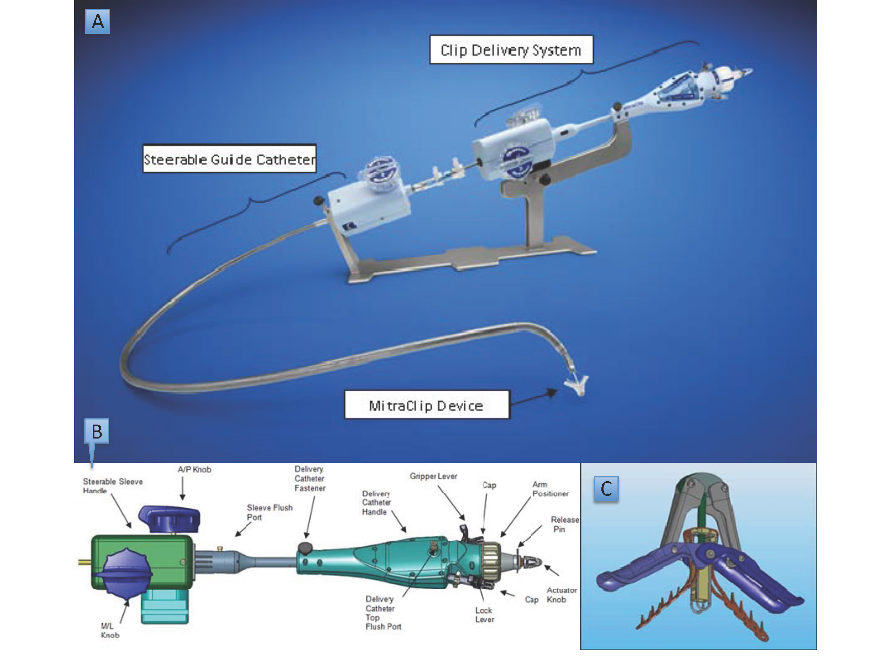 Mitral Regurgitation: Transcatheter Repair